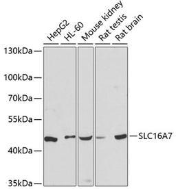 Western blot - SLC16A7 antibody (A12386)