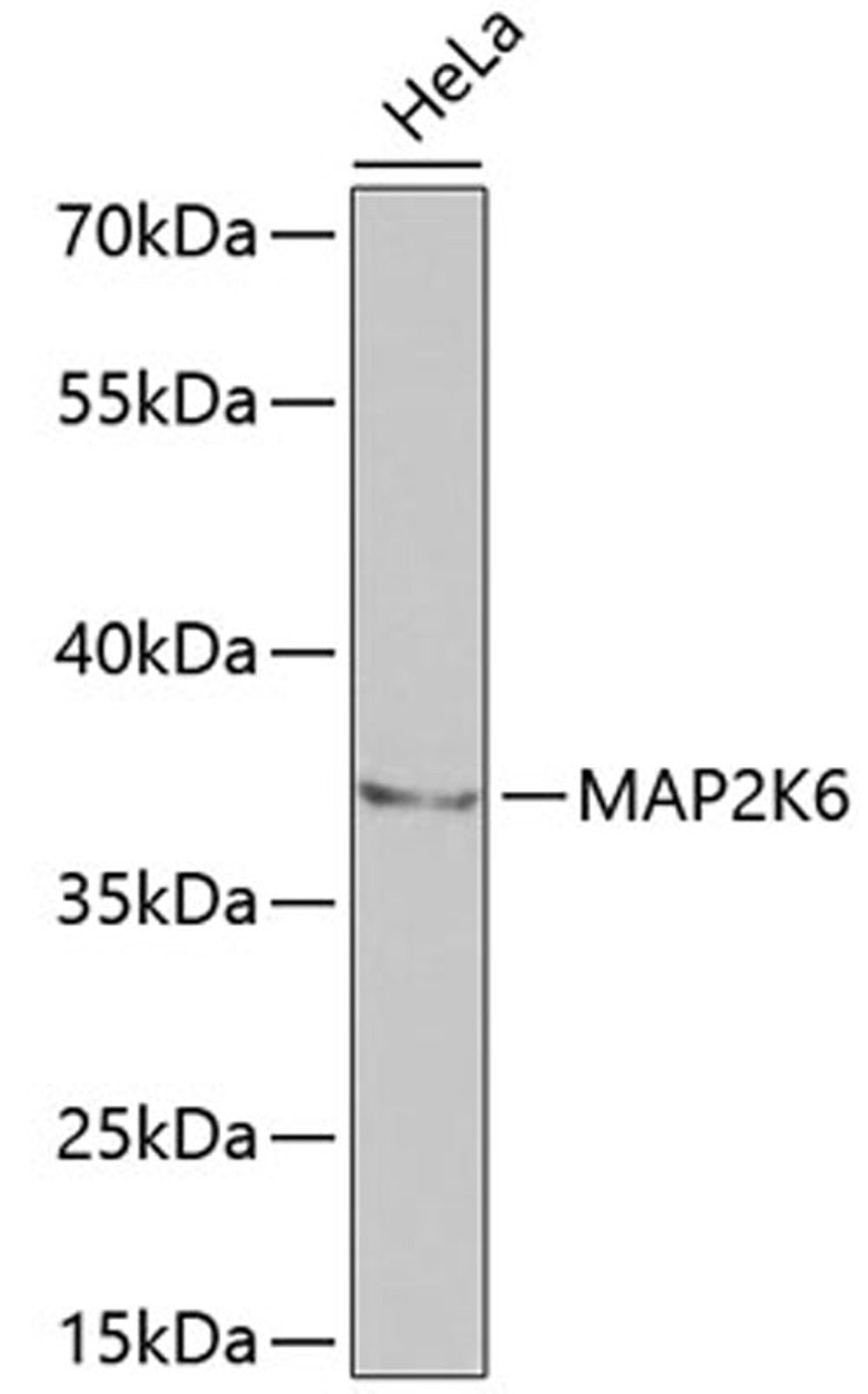 Western blot - MAP2K6 antibody (A2575)