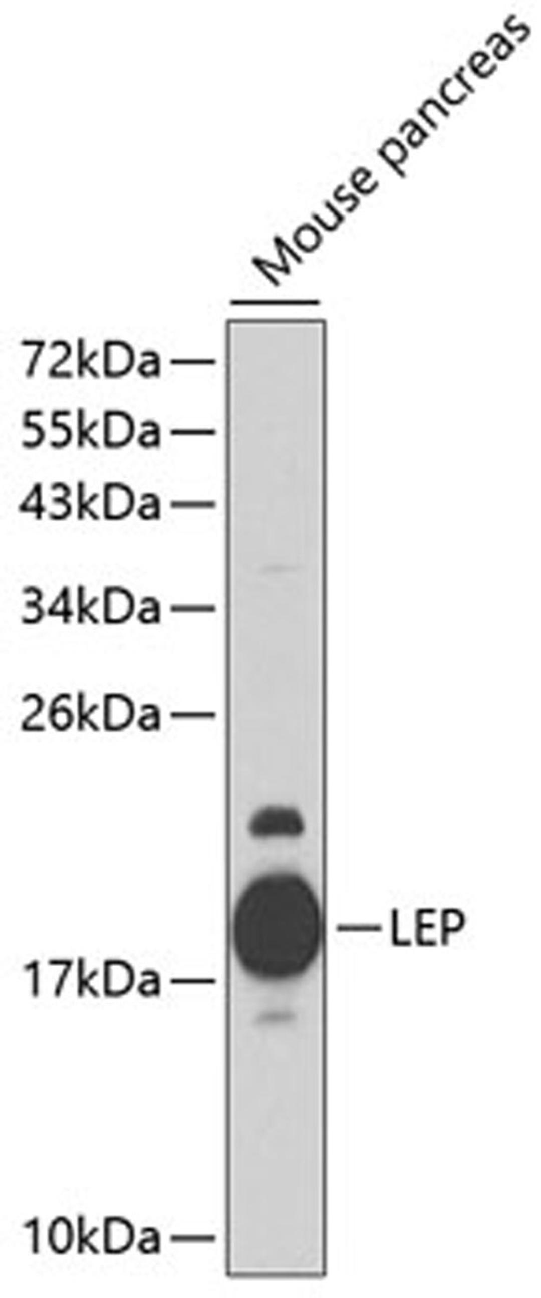 Western blot - LEP antibody (A1300)