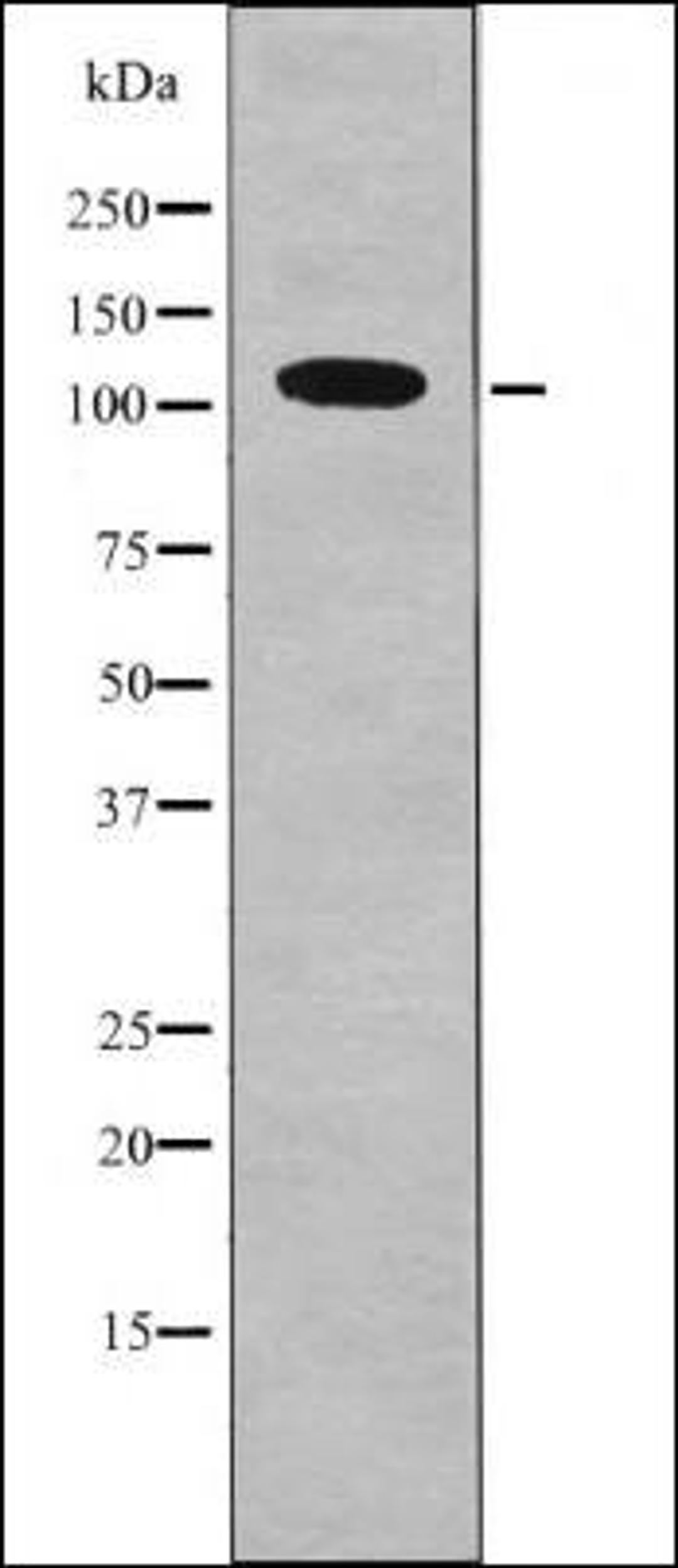 Western blot analysis of MCF7 whole cell lysates using DDR1 -Phospho-Tyr796- antibody