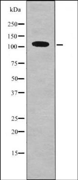 Western blot analysis of MCF7 whole cell lysates using DDR1 -Phospho-Tyr796- antibody