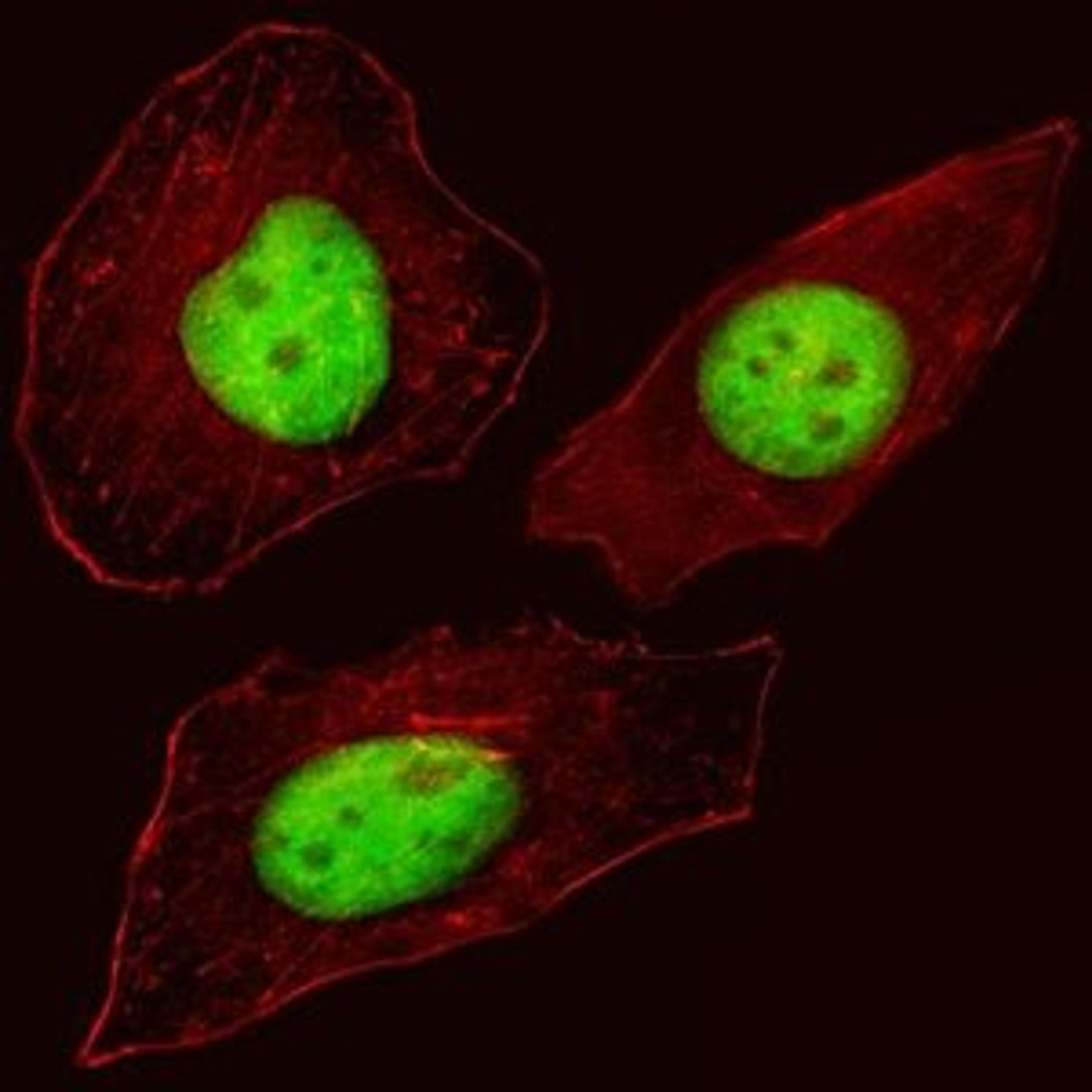 Confocal immunofluoroscence analysis of Hela cell using FOXN3 antibody (C-term)