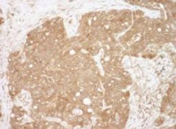 Detection of human CacyBP by immunohistochemistry.