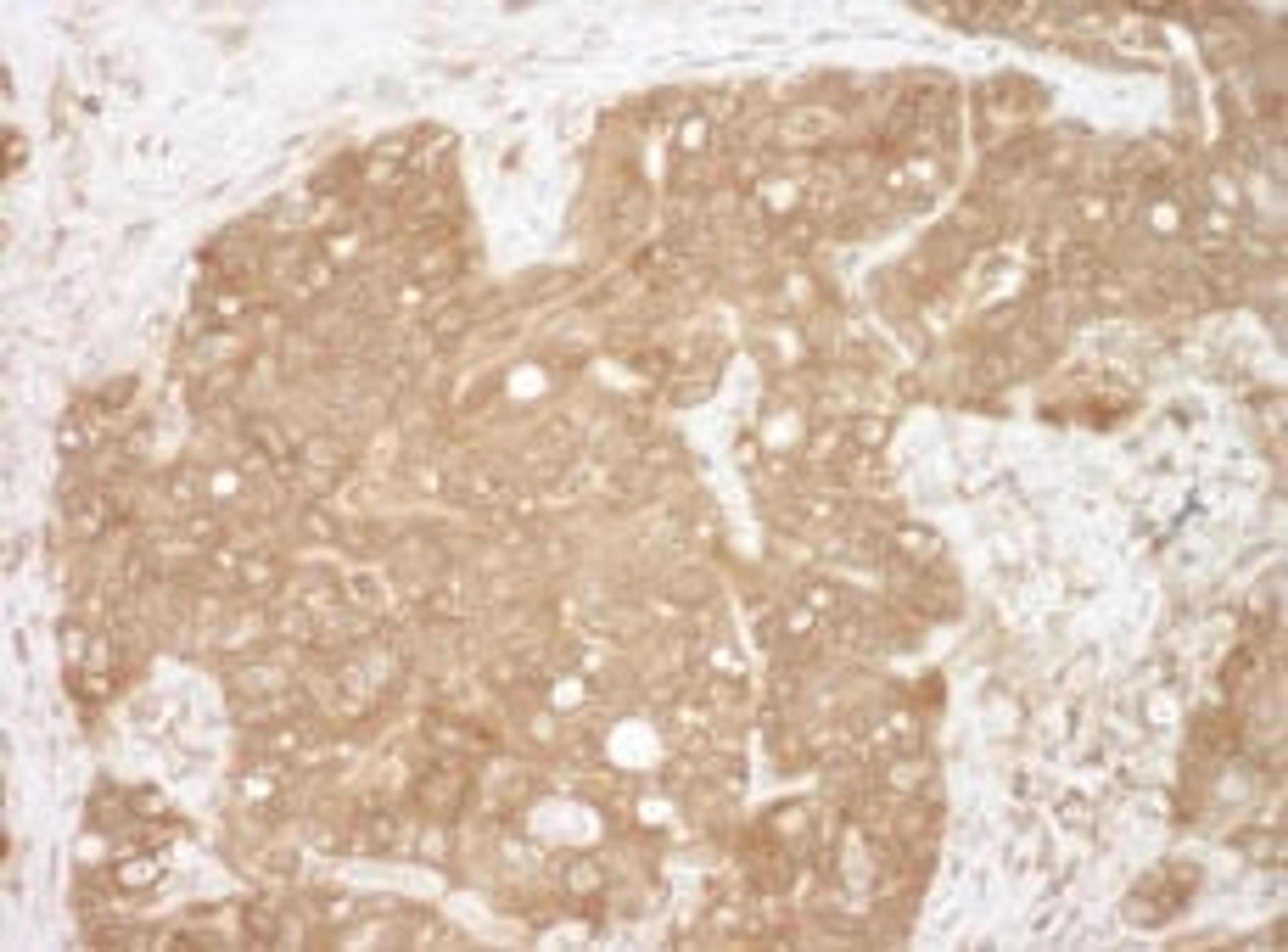 Detection of human CacyBP by immunohistochemistry.