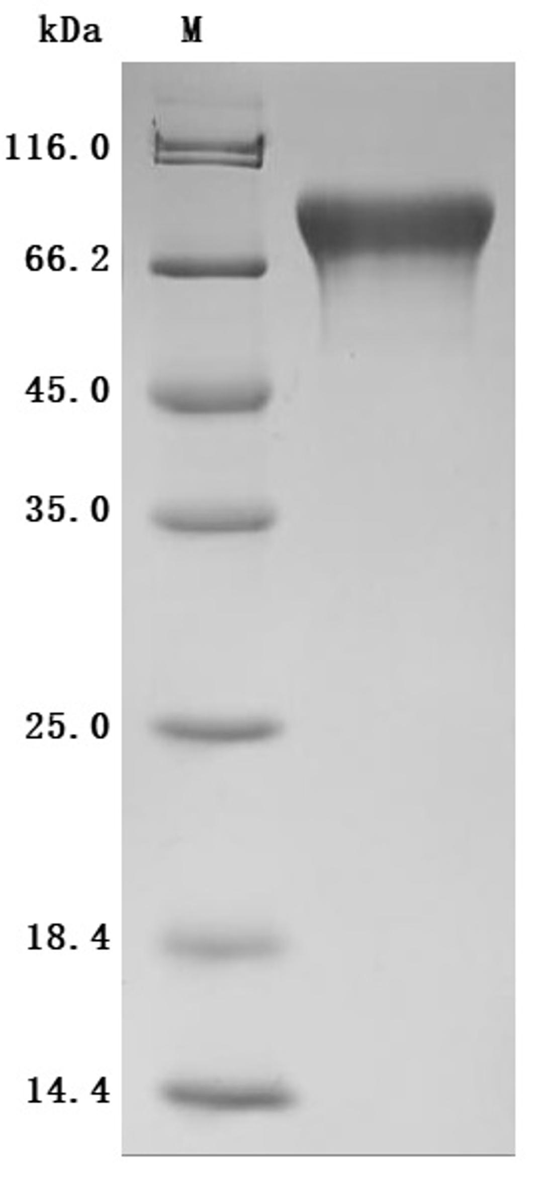 (Tris-Glycine gel) Discontinuous SDS-PAGE (reduced) with 5% enrichment gel and 15% separation gel.