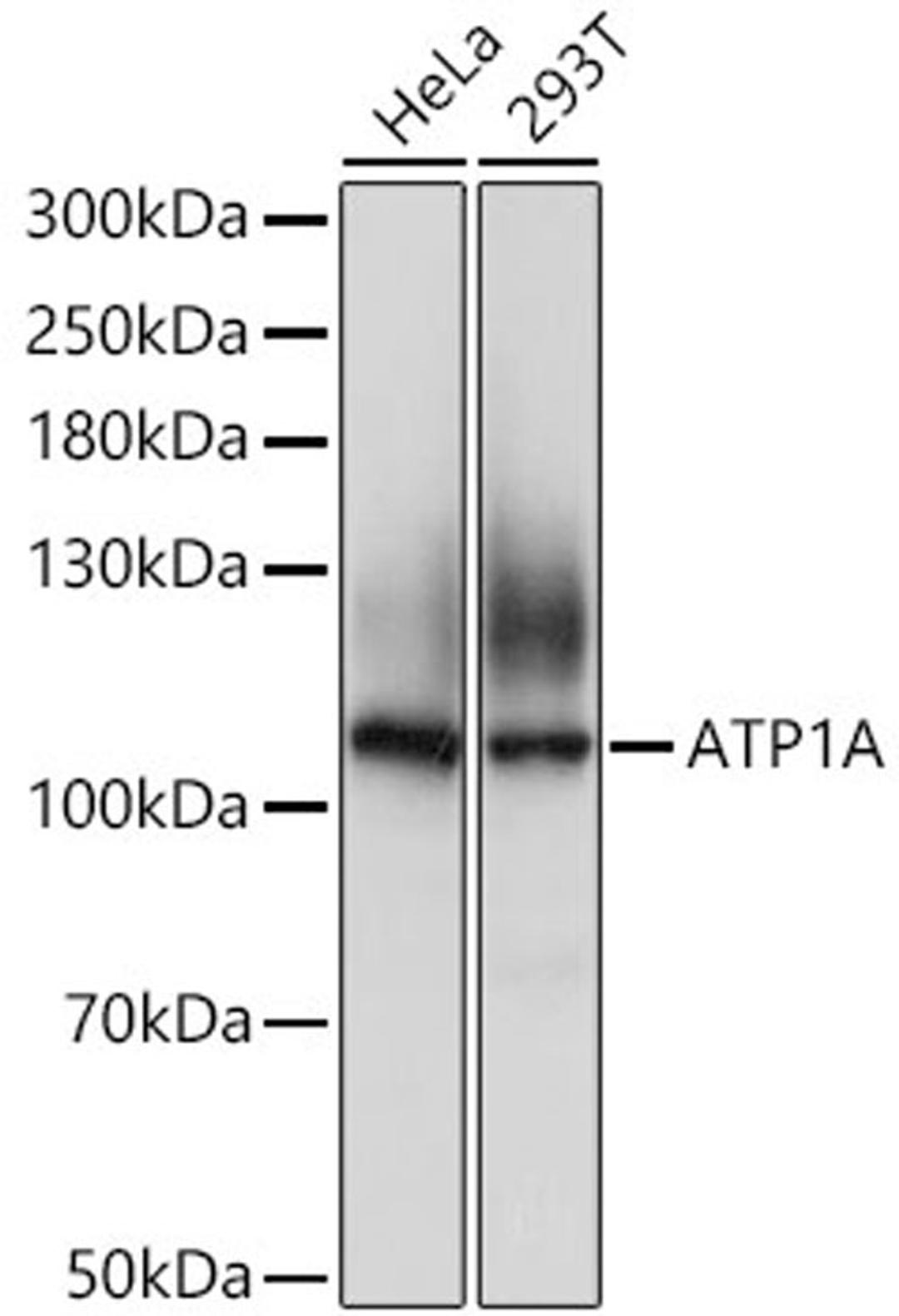 Western blot - ATP1A1 Antibody (A0643)