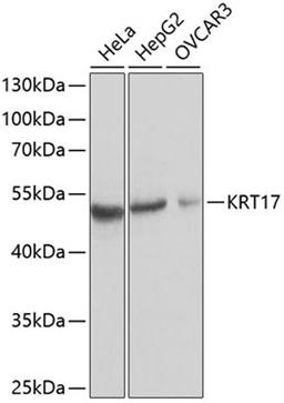 Western blot - KRT17 antibody (A2175)