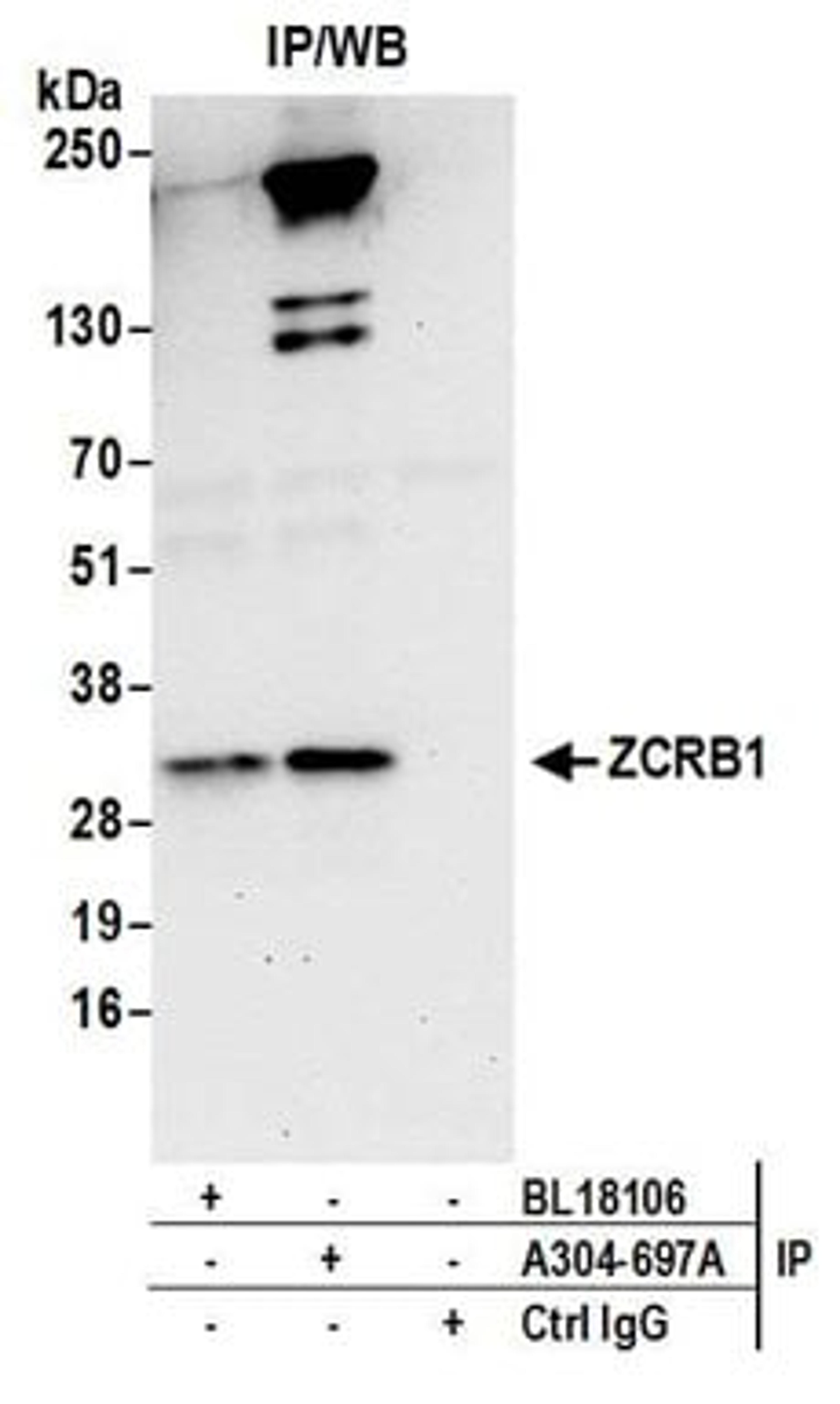 Detection of human ZCRB1 by western blot of immunoprecipitates.