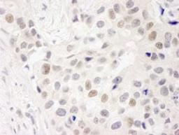 Detection of human INT7 by immunohistochemistry.