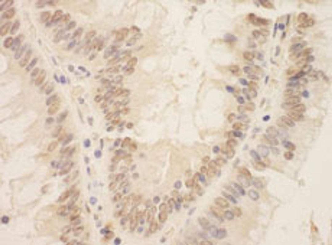 Detection of human ZEB2/SIP by immunohistochemistry.