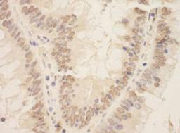 Detection of human ZEB2/SIP by immunohistochemistry.