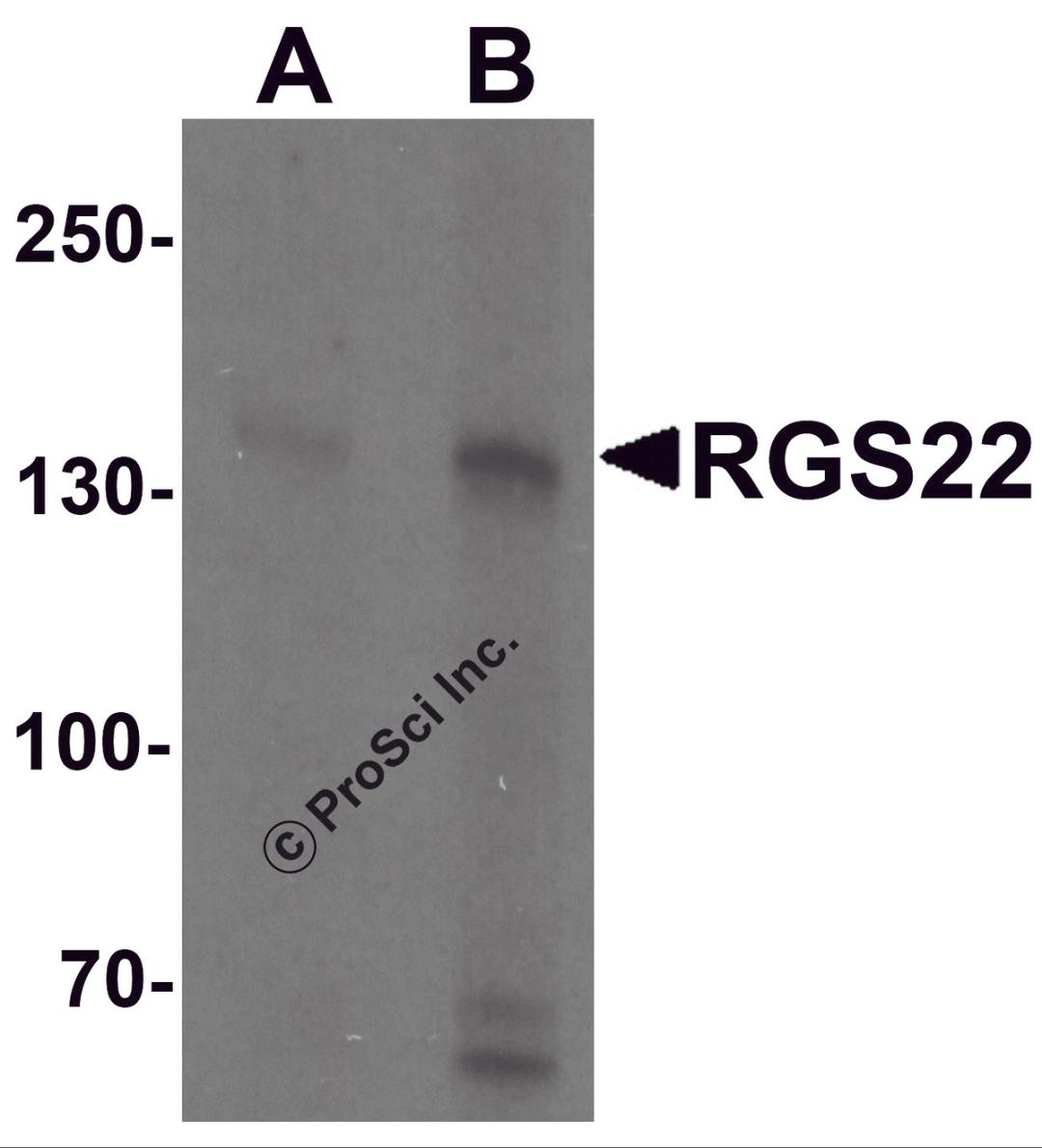 Western blot analysis of RGS22 in Jurkat cell lysate with RGS22 antibody at (A) 1 and (B) 2 μg/mL.