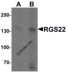 Western blot analysis of RGS22 in Jurkat cell lysate with RGS22 antibody at (A) 1 and (B) 2 μg/mL.