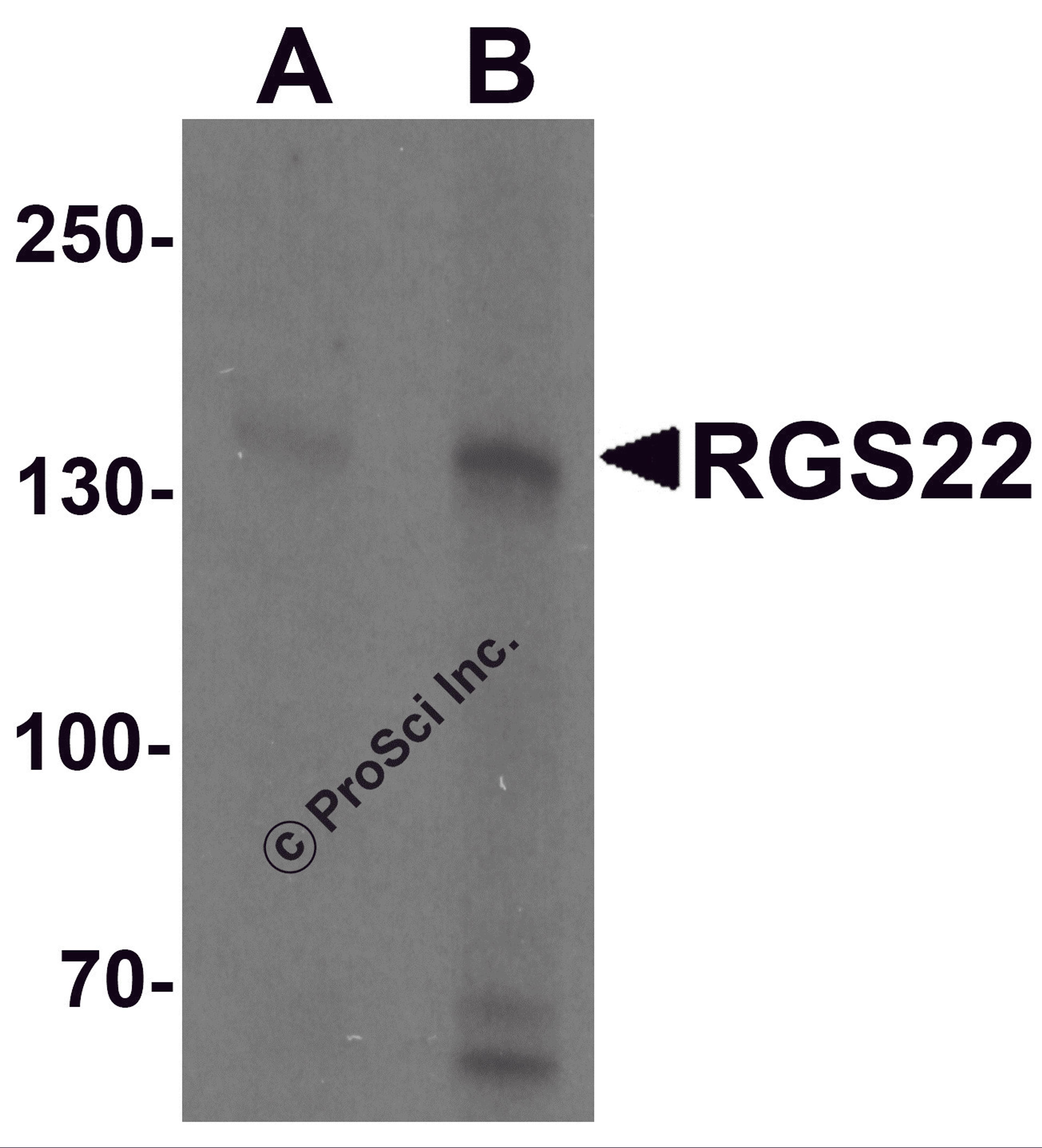 Western blot analysis of RGS22 in Jurkat cell lysate with RGS22 antibody at (A) 1 and (B) 2 μg/mL.