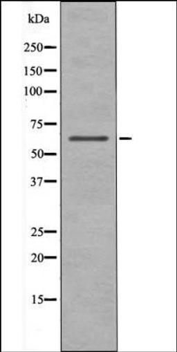 Western blot analysis of Insulin treated 293 whole cell lysates using Chk2 -Phospho-Ser19- antibody