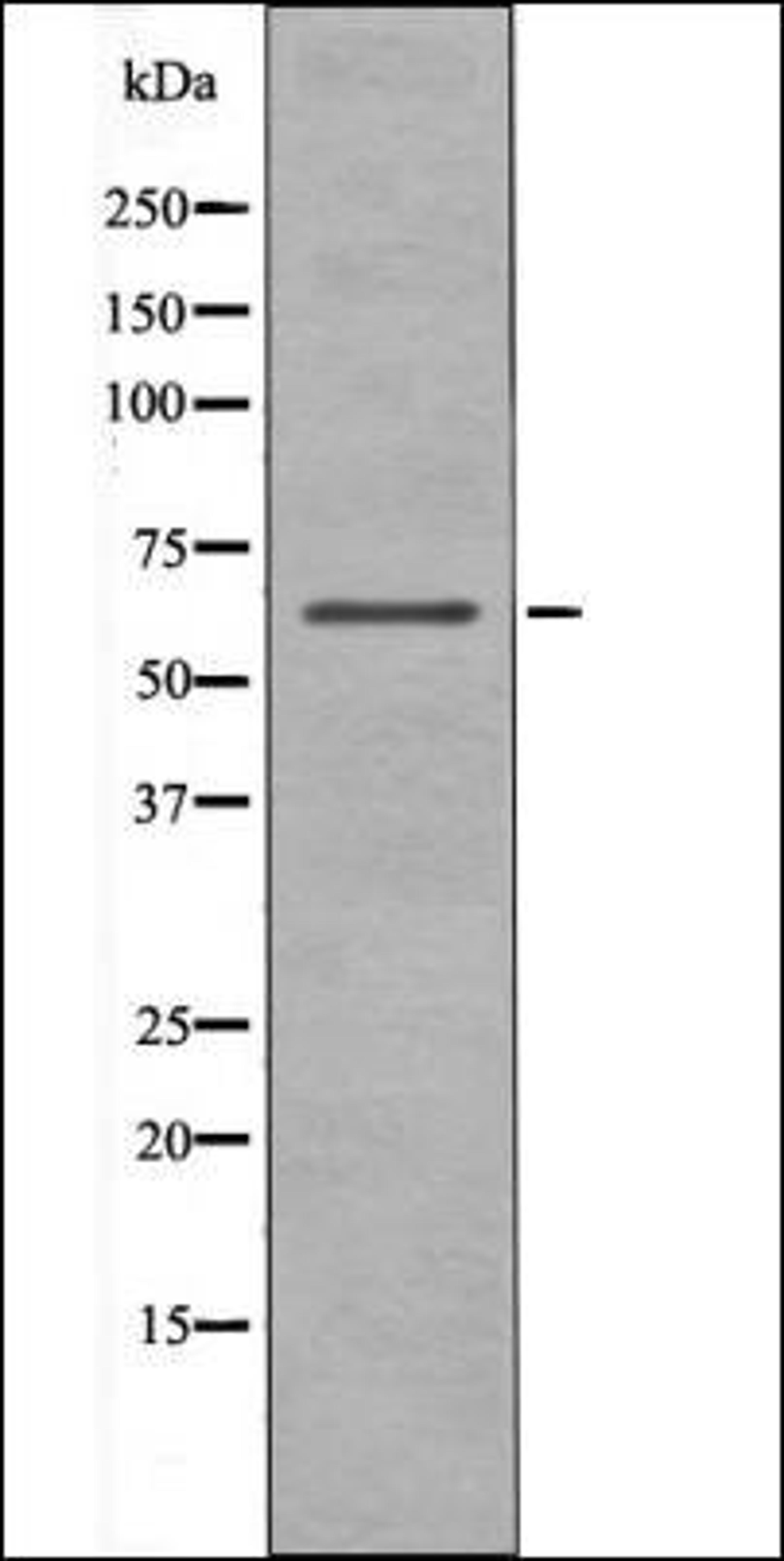 Western blot analysis of Insulin treated 293 whole cell lysates using Chk2 -Phospho-Ser19- antibody