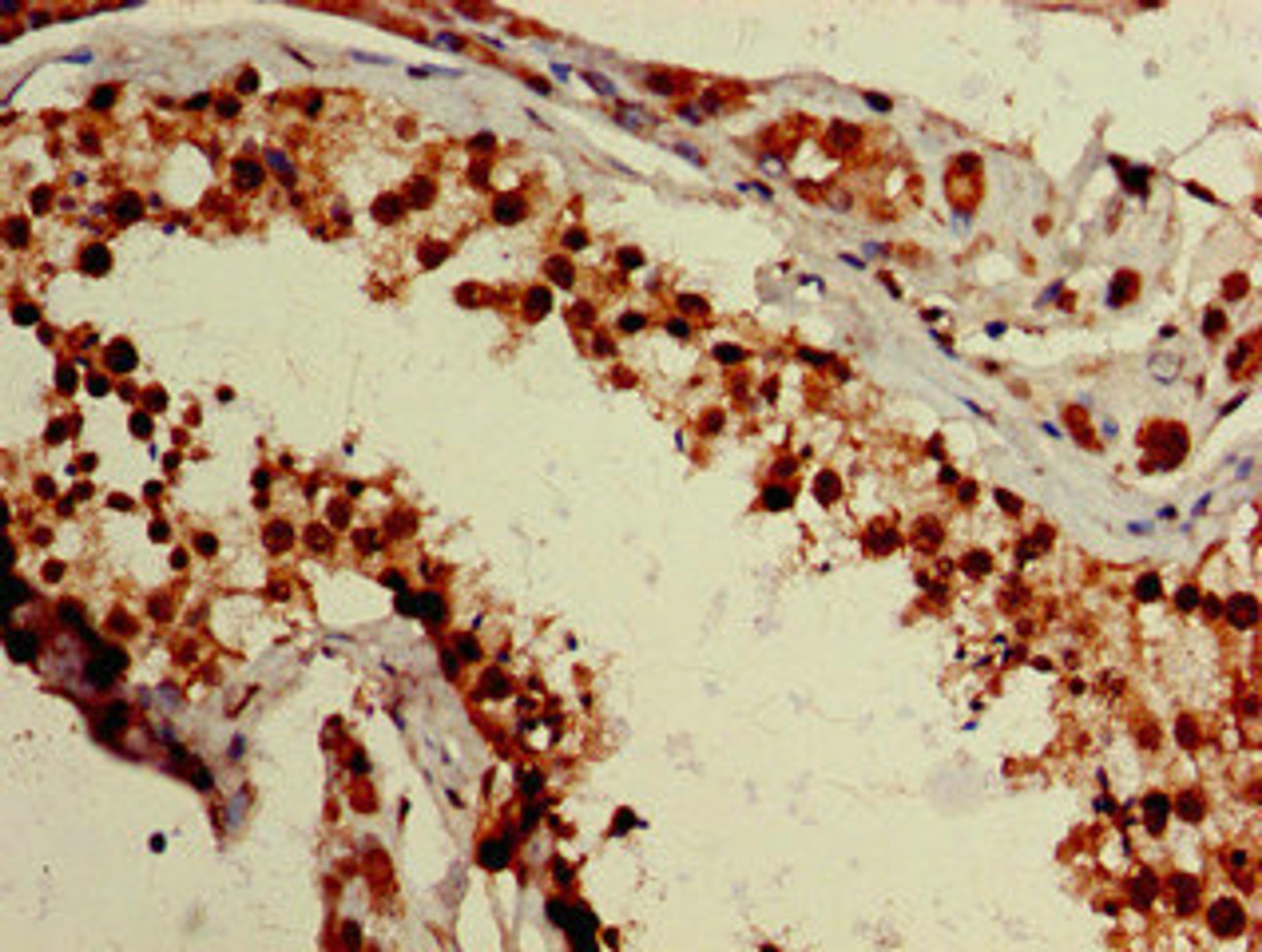 Immunohistochemistry of paraffin-embedded human testis tissue using CSB-PA026680LA01HU at dilution of 1:100