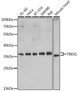 Western blot - TREX1 antibody (A6778)