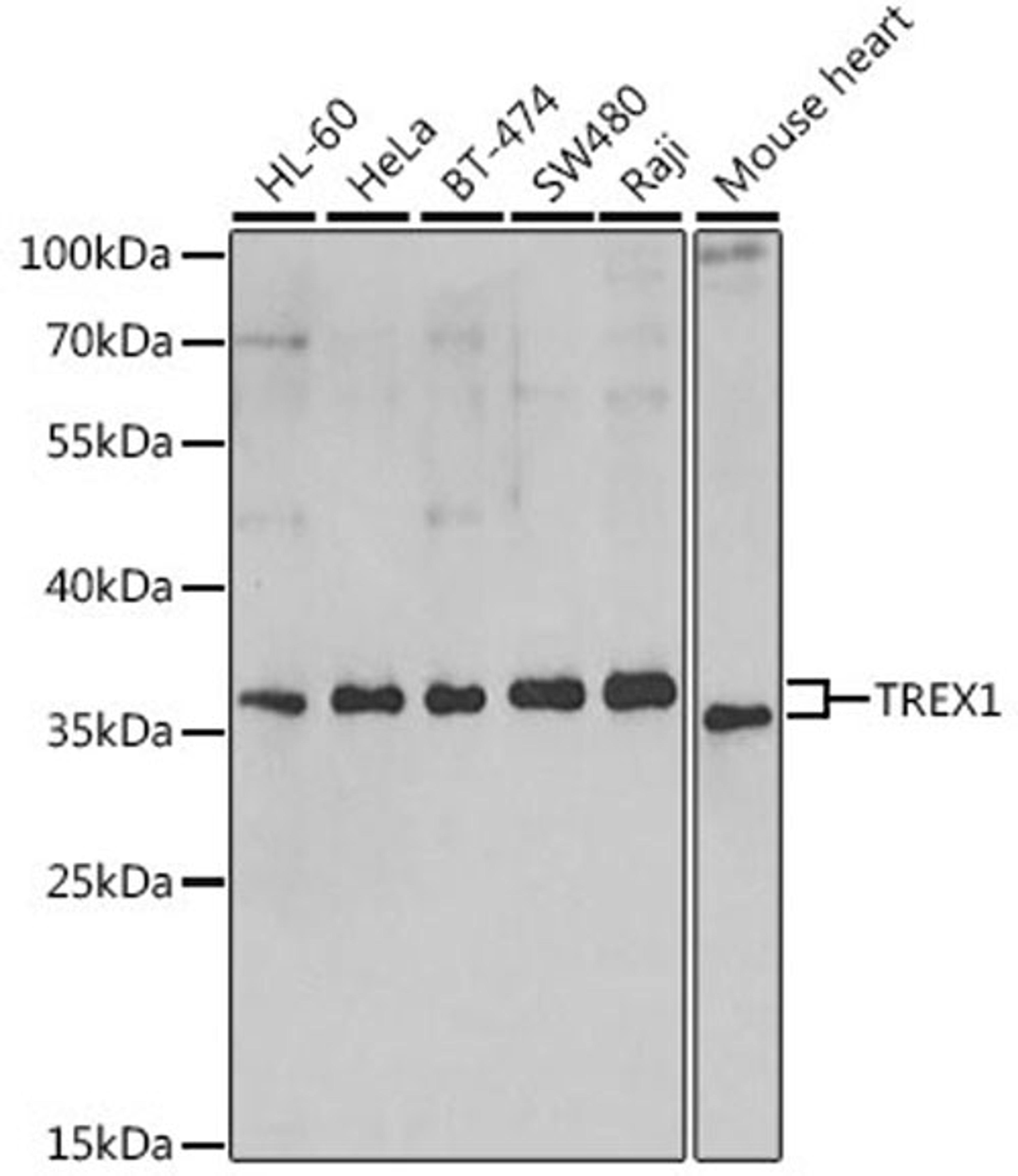 Western blot - TREX1 antibody (A6778)