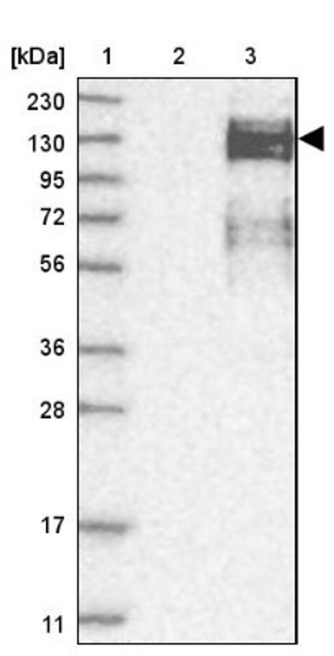 Western Blot: ZEB1 Antibody [NBP1-88845] - Lane 1: Marker [kDa] 230, 130, 95, 72, 56, 36, 28, 17, 11<br/>Lane 2: Human cell line RT-4<br/>Lane 3: Human cell line U-251MG sp