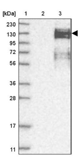 Western Blot: ZEB1 Antibody [NBP1-88845] - Lane 1: Marker [kDa] 230, 130, 95, 72, 56, 36, 28, 17, 11<br/>Lane 2: Human cell line RT-4<br/>Lane 3: Human cell line U-251MG sp