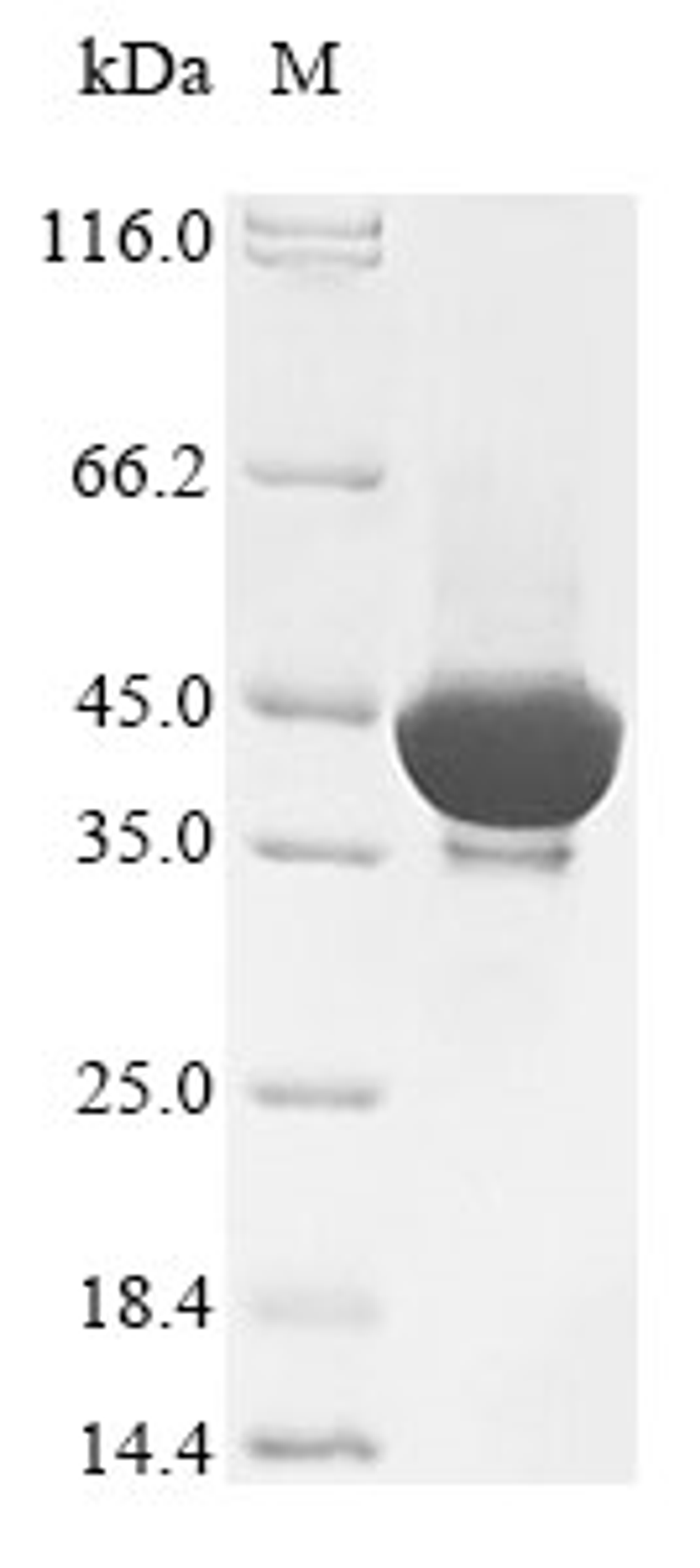 (Tris-Glycine gel) Discontinuous SDS-PAGE (reduced) with 5% enrichment gel and 15% separation gel.