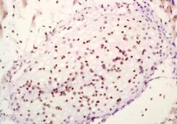 Immunohistochemical analysis of formalin-fixed paraffin embedded mouse embryo tissue using SOX11 antibody (dilution at 1:200)