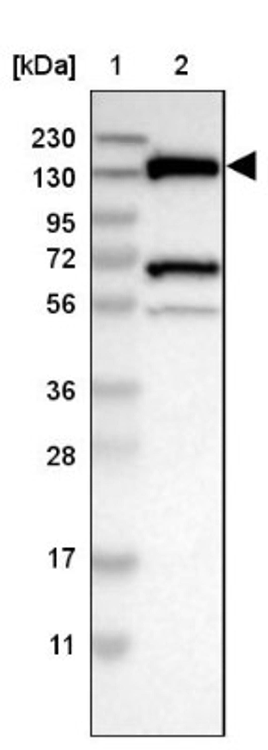 Western Blot: LOK Antibody [NBP2-13396] - Lane 1: Marker [kDa] 230, 130, 95, 72, 56, 36, 28, 17, 11<br/>Lane 2: Human cell line RT-4