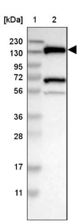 Western Blot: LOK Antibody [NBP2-13396] - Lane 1: Marker [kDa] 230, 130, 95, 72, 56, 36, 28, 17, 11<br/>Lane 2: Human cell line RT-4