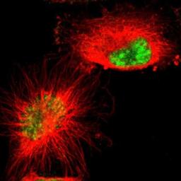 Immunocytochemistry/Immunofluorescence: GRK3 Antibody [NBP1-90008] - Staining of human cell line U-251MG shows positivity in nucleus.