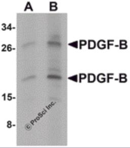 Western blot analysis of PDGF-B in rat liver tissue lysate with PDGF-B antibody at (A) 1 and (B) 2 &#956;g/mL.