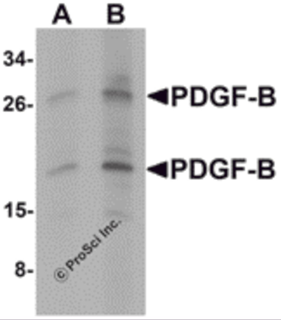 Western blot analysis of PDGF-B in rat liver tissue lysate with PDGF-B antibody at (A) 1 and (B) 2 μg/mL.