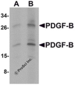 Western blot analysis of PDGF-B in rat liver tissue lysate with PDGF-B antibody at (A) 1 and (B) 2 μg/mL.