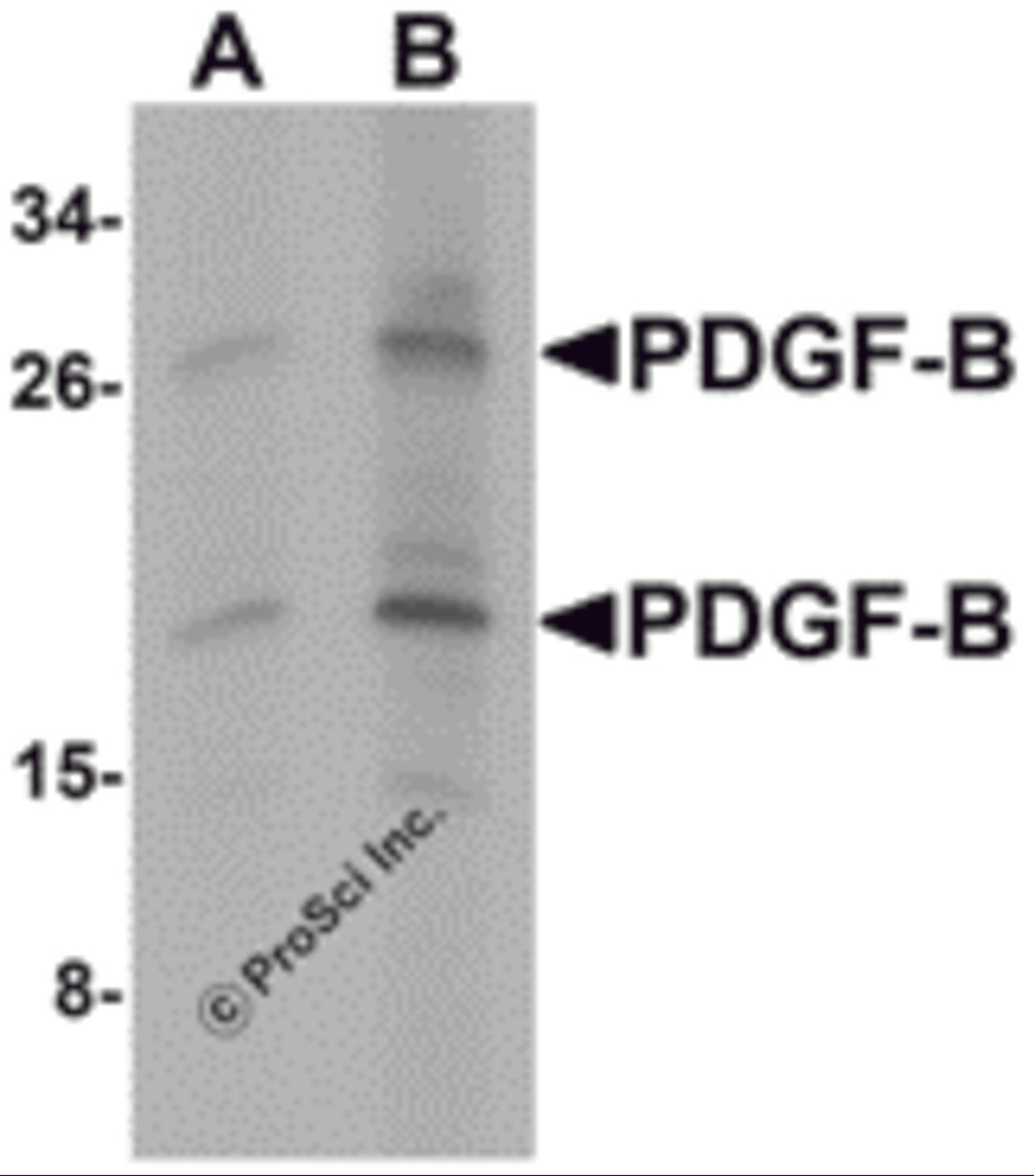 Western blot analysis of PDGF-B in rat liver tissue lysate with PDGF-B antibody at (A) 1 and (B) 2 μg/mL.