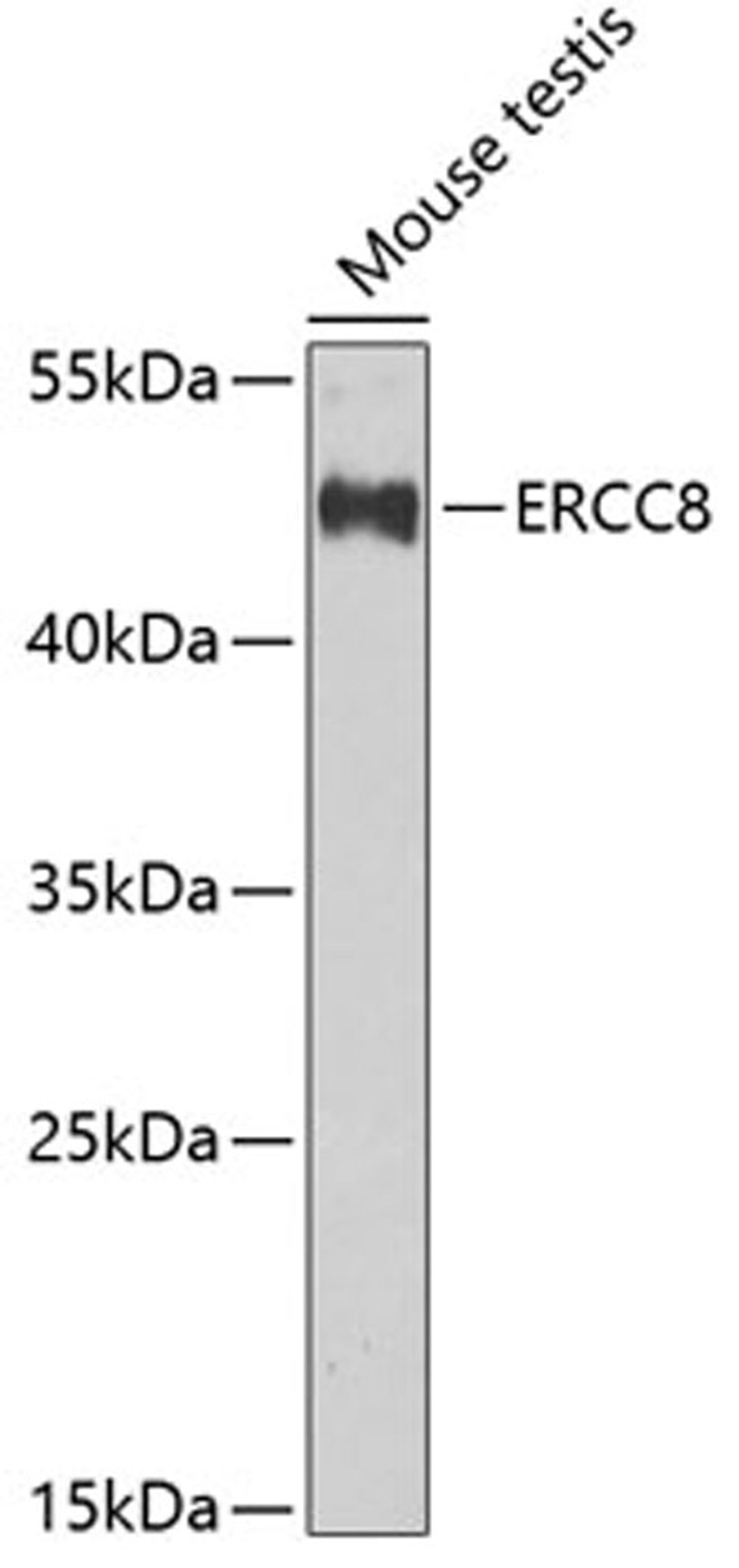 Western blot - ERCC8 Antibody (A6884)