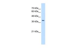 Antibody used in WB on Human HepG2 at 2.5 ug/ml.