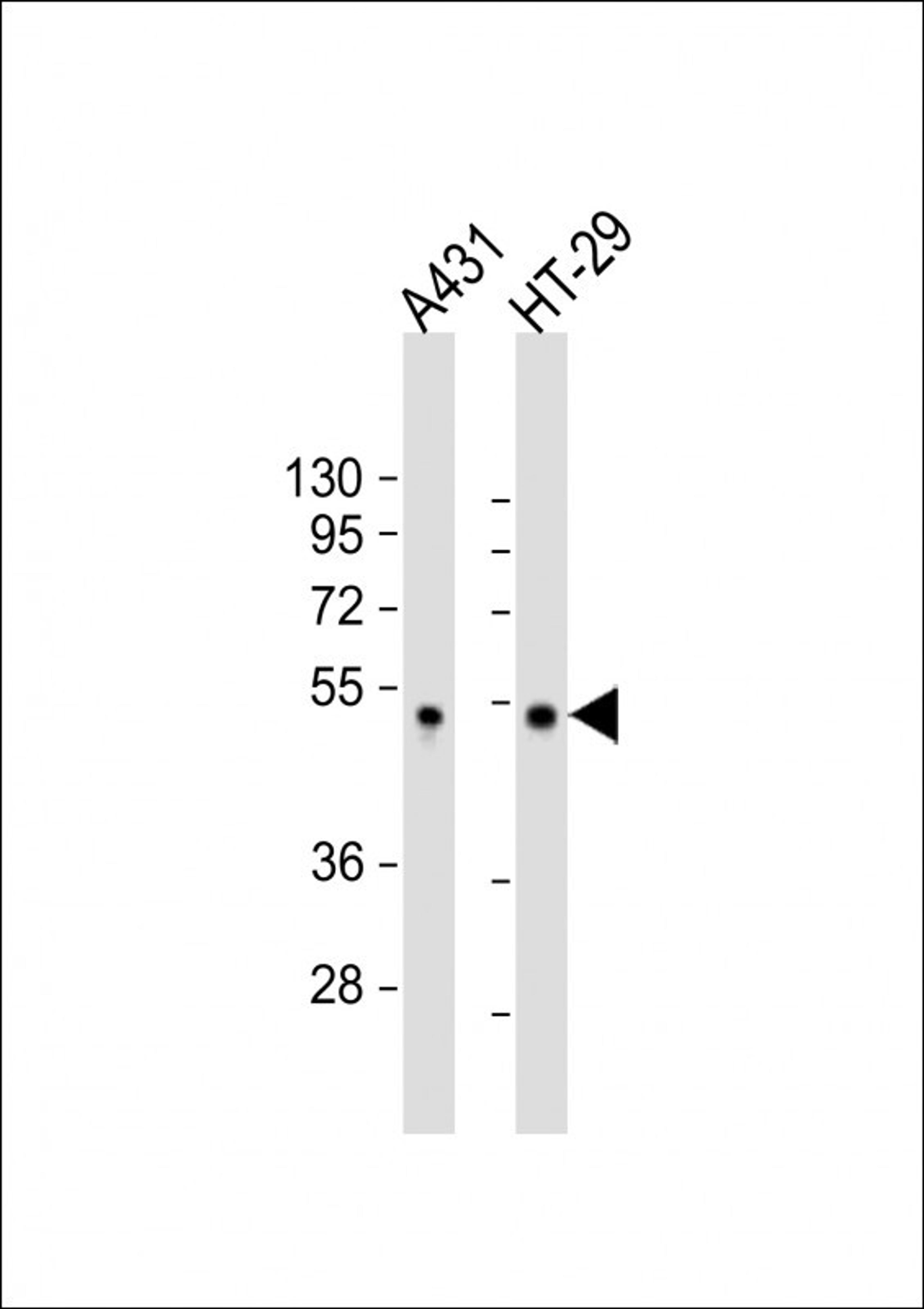 Western Blot at 1:2000 dilution Lane 1: A431 whole cell lysate Lane 2: HT-29 whole cell lysate Lysates/proteins at 20 ug per lane.