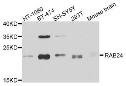 Western blot analysis of extracts of various cell lines using RAB24 antibody