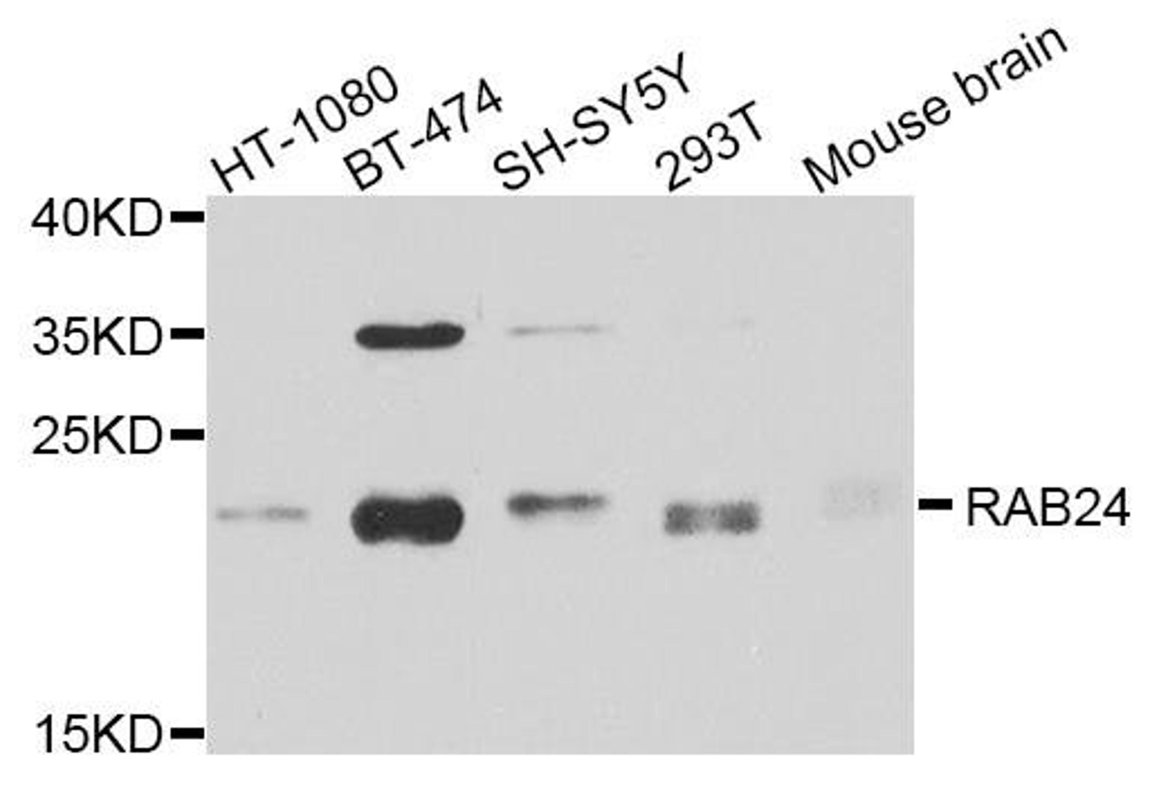 Western blot analysis of extracts of various cell lines using RAB24 antibody