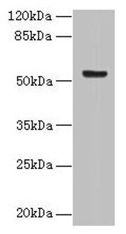 Western blot. All lanes: DENND2D antibody at 4µg/ml + MCF-7 whole cell lysate. Secondary. Goat polyclonal to rabbit IgG at 1/10000 dilution. Predicted band size: 54 kDa. Observed band size: 54 kDa