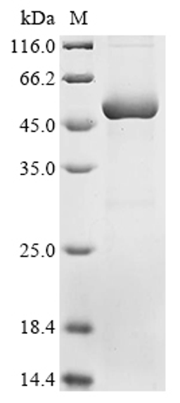 (Tris-Glycine gel) Discontinuous SDS-PAGE (reduced) with 5% enrichment gel and 15% separation gel.