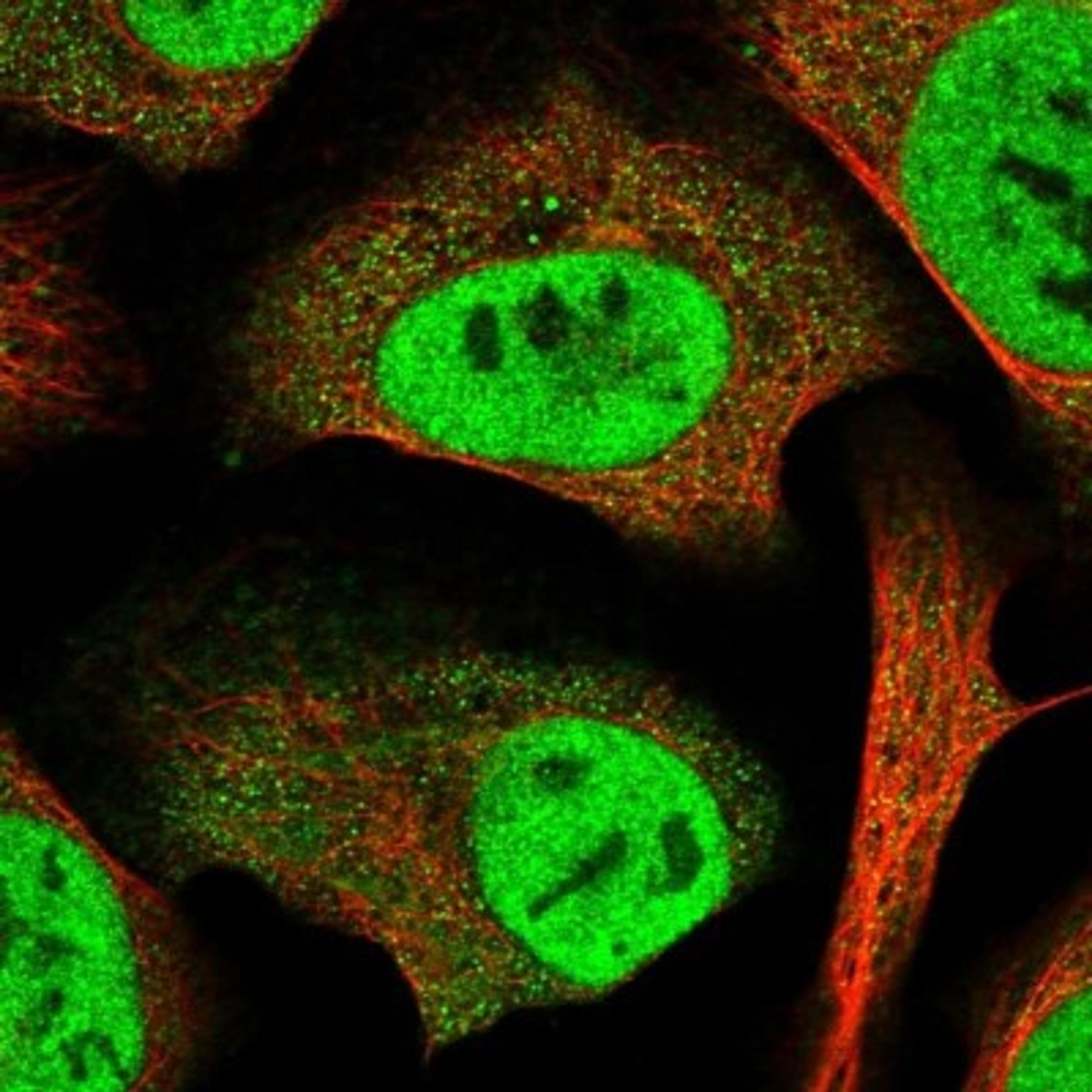 Immunocytochemistry/Immunofluorescence: SERTAD2 Antibody [NBP1-81541] - Staining of human cell line U-2 OS shows positivity in nucleus but not nucleoli & cytoplasm.