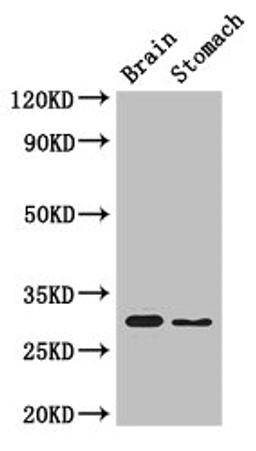 Western Blot. Positive WB detected in: Mouse brain tissue, Mouse stomach tissue. All lanes: COPS7B antibody at 3µg/ml. Secondary. Goat polyclonal to rabbit IgG at 1/50000 dilution. Predicted band size: 30, 19, 31 kDa. Observed band size: 30 kDa