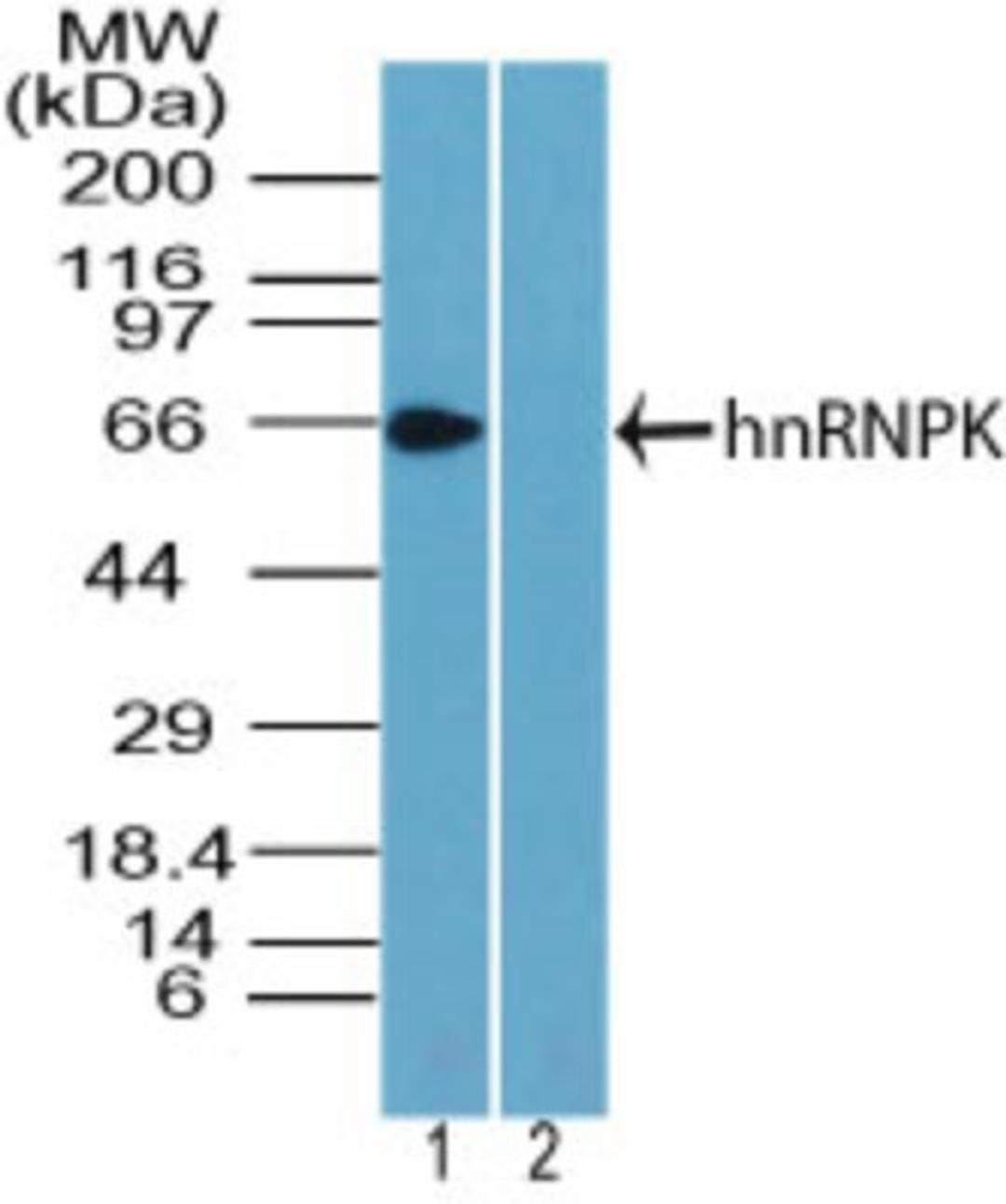 Western Blot: hnRNP K Antibody [NBP2-24531] - analysis of hnRNPK in K562 cell lysate in the 1) absence and 2) presence of immunizing peptide using this antibody. I goat anti-rabbit Ig HRP secondary antibody and PicoTect ECL substrate solution were used for this test.