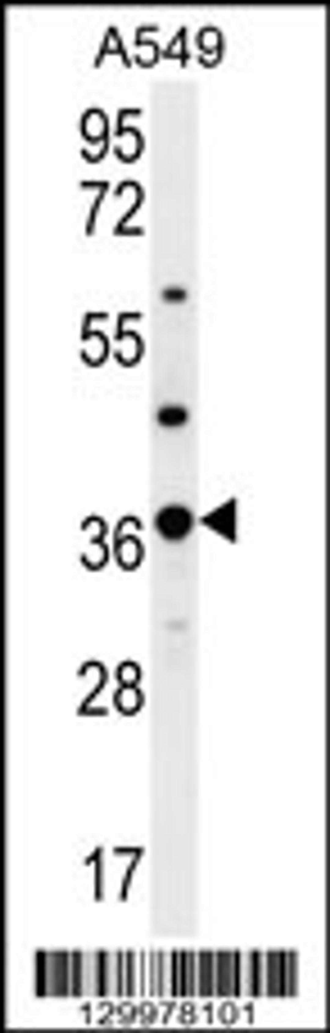 Western blot analysis in A549 cell line lysates (35ug/lane).