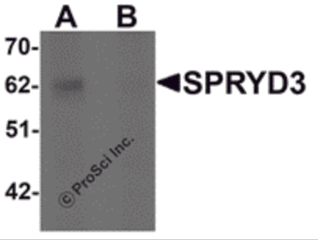 Western blot analysis of SPRYD3 in human brain tissue lysate with SPRYD3 antibody at 1 &#956;g/mL in (A) the absence and (B) the presence of blocking peptide