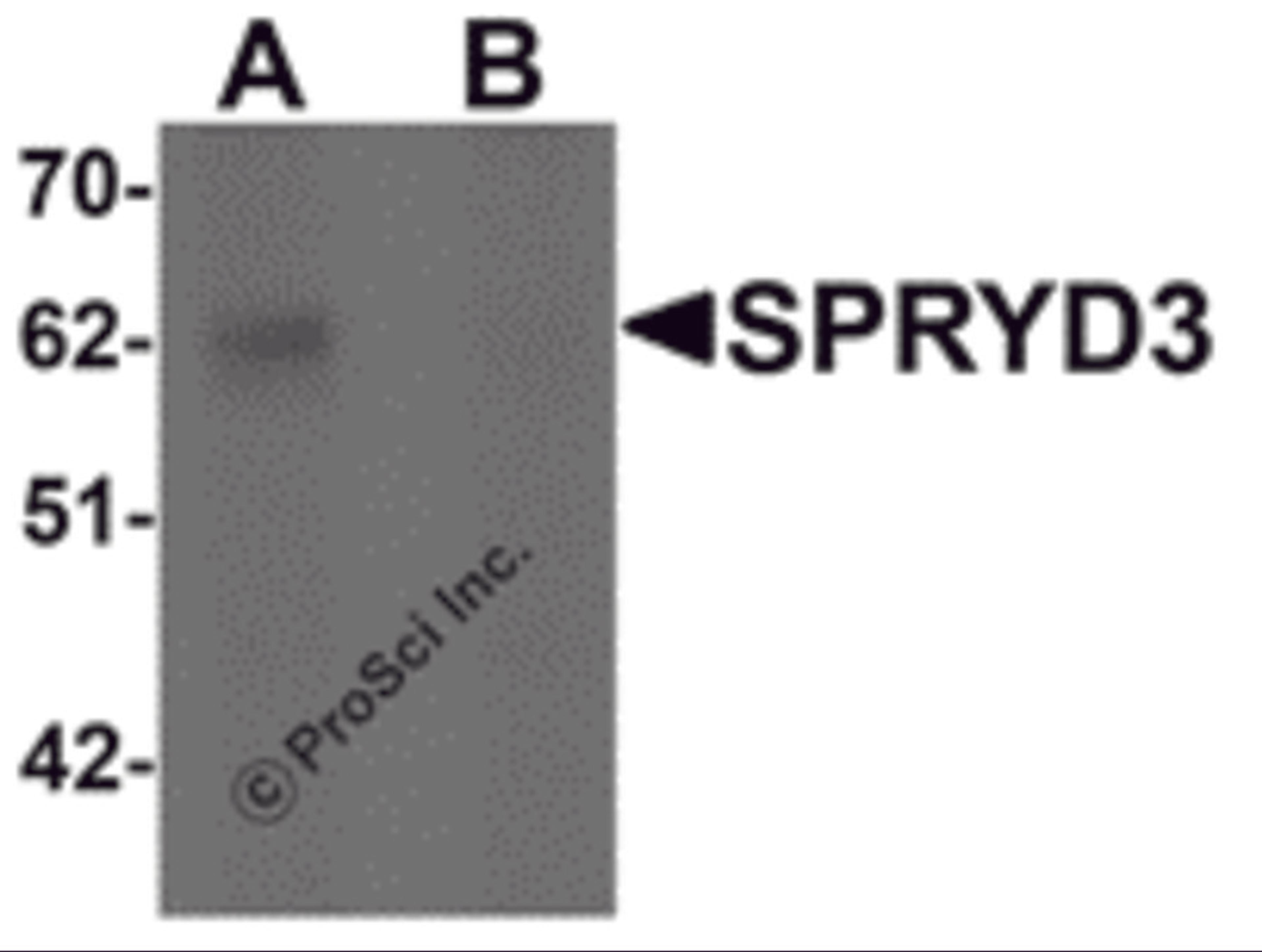 Western blot analysis of SPRYD3 in human brain tissue lysate with SPRYD3 antibody at 1 &#956;g/mL in (A) the absence and (B) the presence of blocking peptide