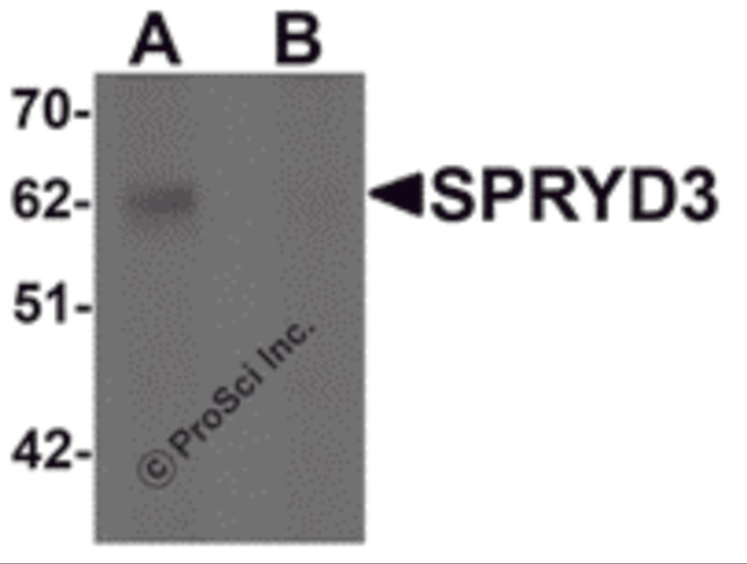 Western blot analysis of SPRYD3 in human brain tissue lysate with SPRYD3 antibody at 1 μg/mL in (A) the absence and (B) the presence of blocking peptide
