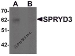 Western blot analysis of SPRYD3 in human brain tissue lysate with SPRYD3 antibody at 1 μg/mL in (A) the absence and (B) the presence of blocking peptide