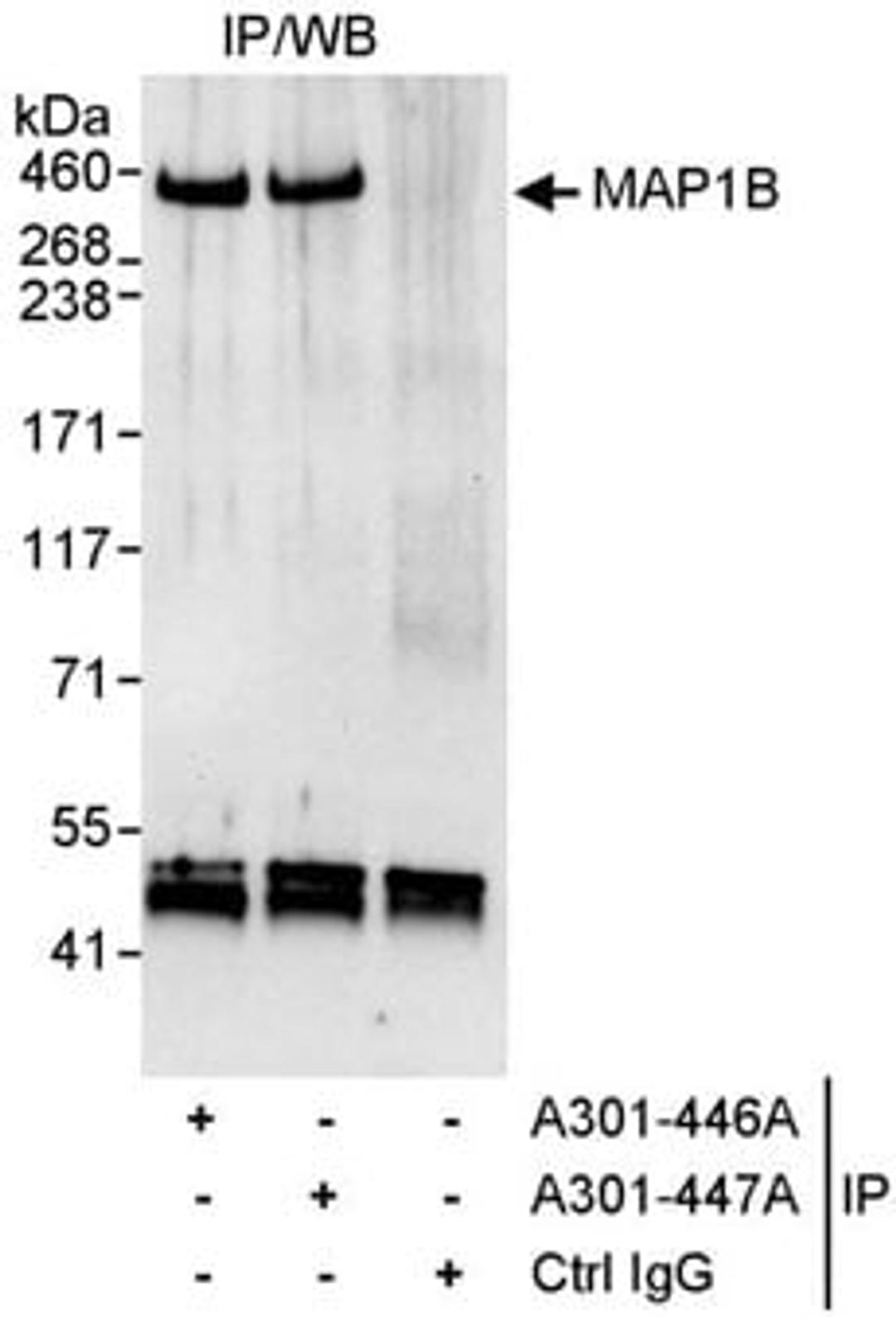 Detection of human MAP1B by western blot of immunoprecipitates.